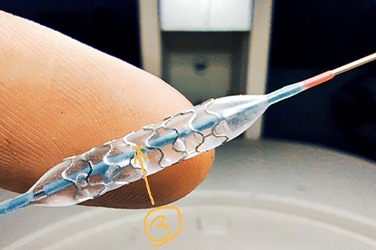 鎂合金血管支架殘余應(yīng)力測(cè)試1